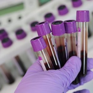 MagSi-DNA Body Fluid